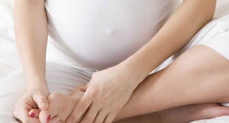 Симптомы варикозного расширения вен у беременных
