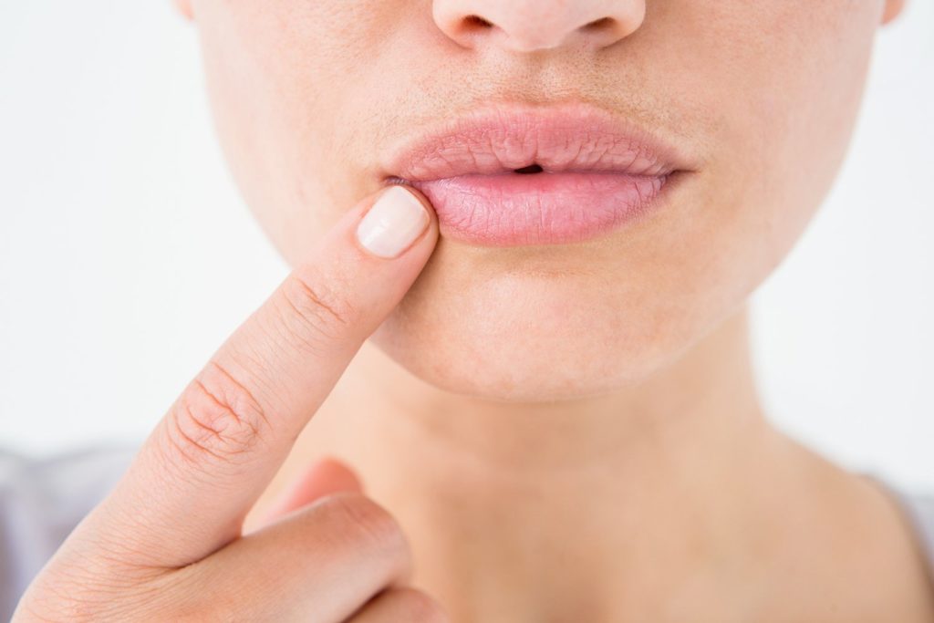 заеды в уголках губ причины и лечение