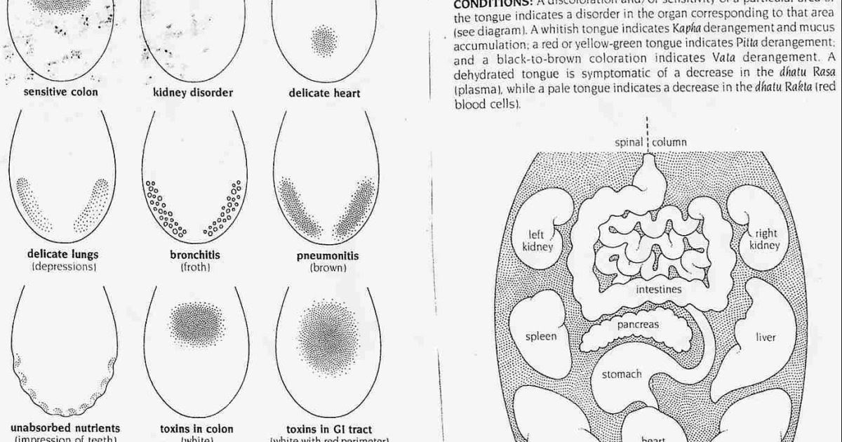 Диагностика по языку в картинках болезней человека цвету
