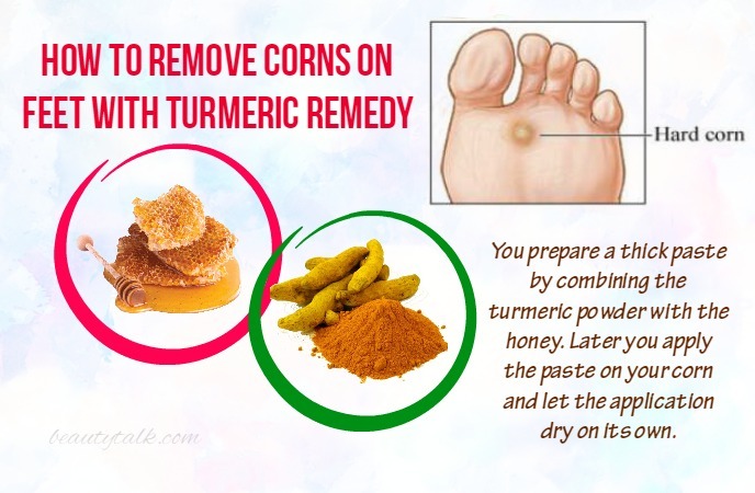 how to remove corns on feet 