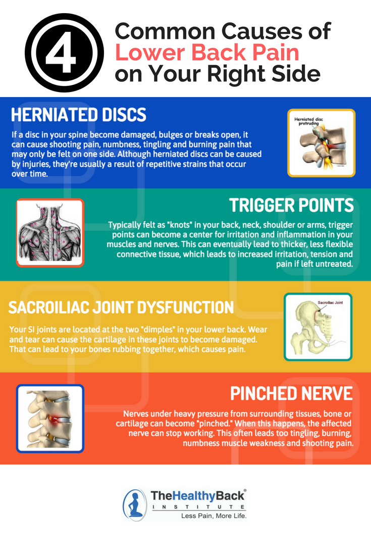 pinched nerve pain 