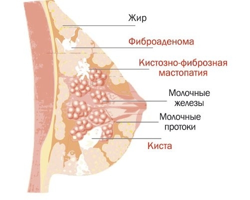 жжение в груди