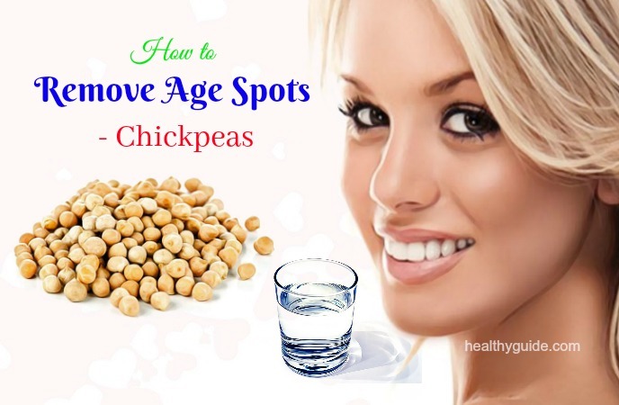 how to remove age spots