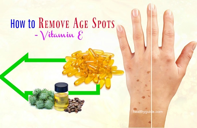 how to remove age spots 