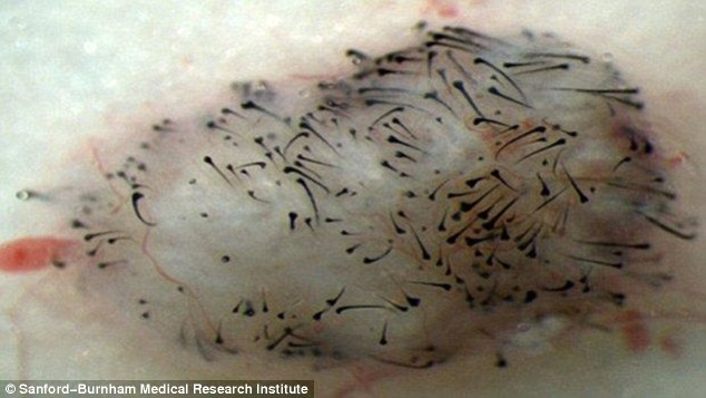 Researchers in Orlando have come a step closer to a natural treatment for baldness after successfully growing new hair using human stem cells. Pictured is the hair growth on the leg of an adult rat