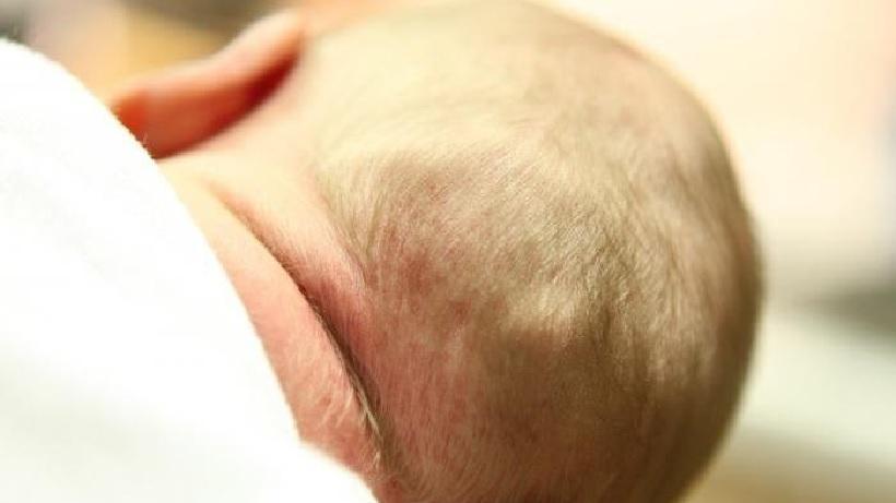 Новообразования часто можно увидеть у новорожденных, как следствие получения травмы в процессе родовой деятельности