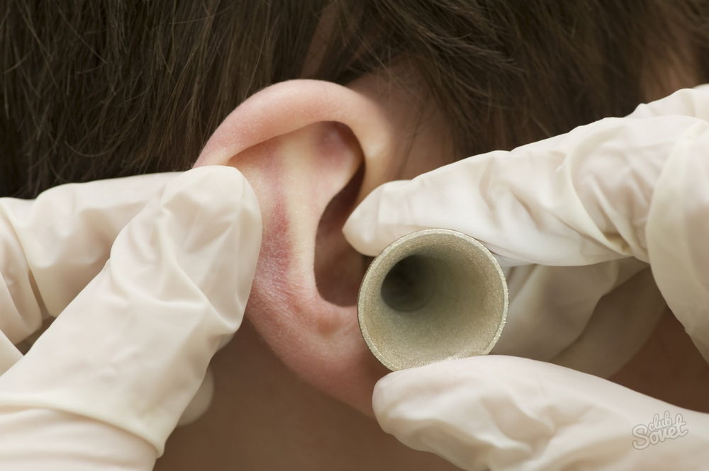 Грибок в ушах: симптомы, причины и лечение