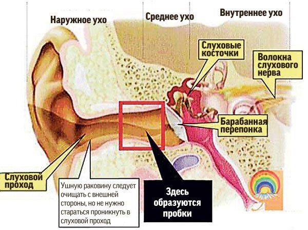 Причины возникновения серных пробок (ушных пробок)