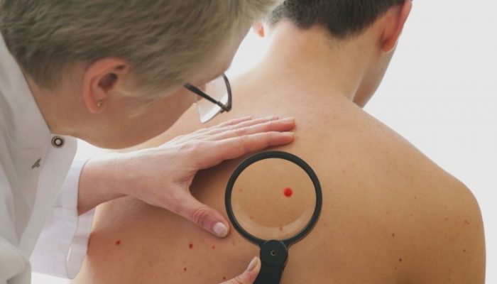Почему появляются красные точки на теле? Возможные болезни и методы их лечения