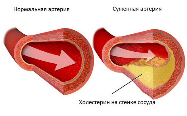 сосуды