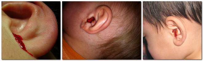 Кровь из уха