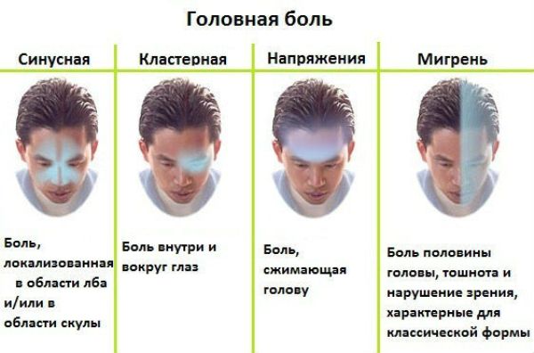 Основные виды головной боли и их характеристики
