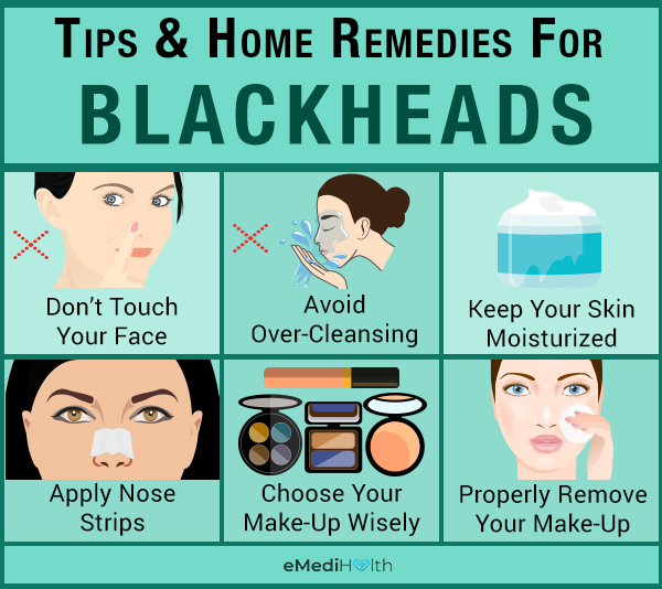 self-care tips to manage blackheads