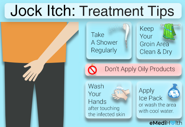 self-care tips to aid relief from jock itch