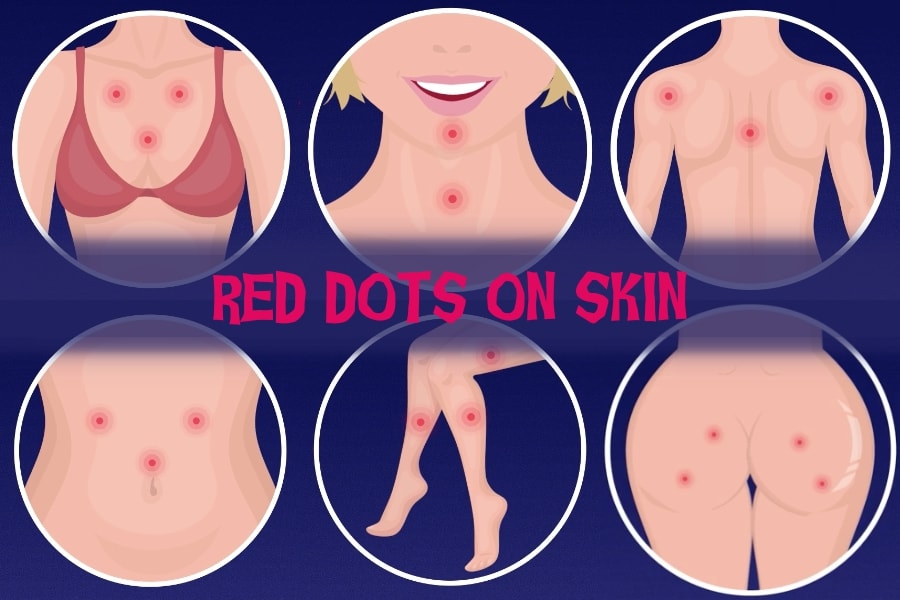 Little Red Dots On Skin