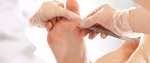 Callus Removal, Foot and Ankle Specialists Los Angels