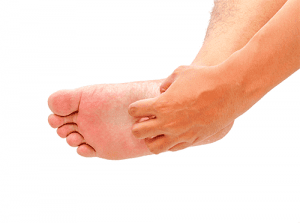 Itchy Feet, Eczema on Foot, University Foot and Ankle Institute Los Angeles