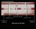 decapsulation test with staphylococcus aureus 