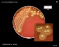 s.aureus growth on Schaedler agar