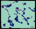 Gram staining technique