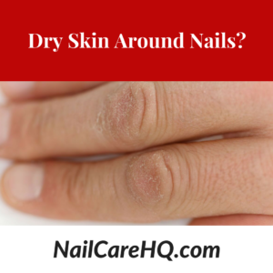 How do I prevent hard dry skin around my nails? 