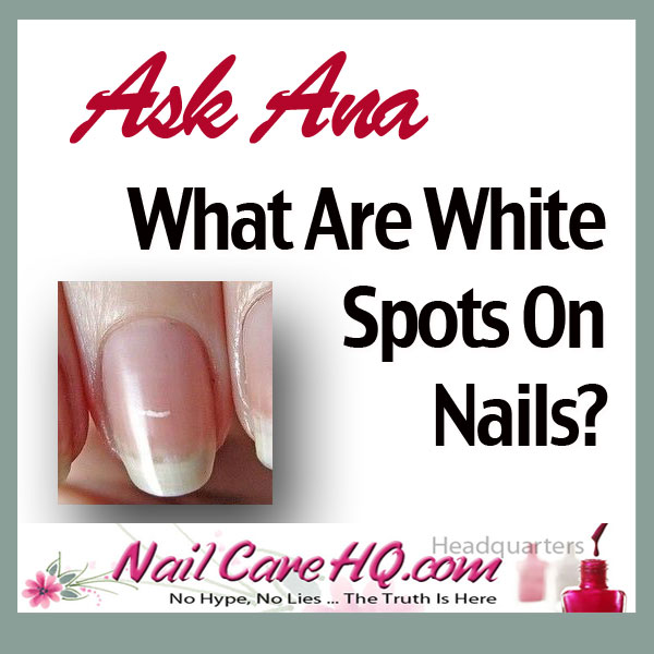 white-spots-on-nails-nailcarehq