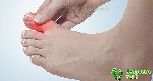 Если при диабете болит большой палец ноги, то это повод начать лечение